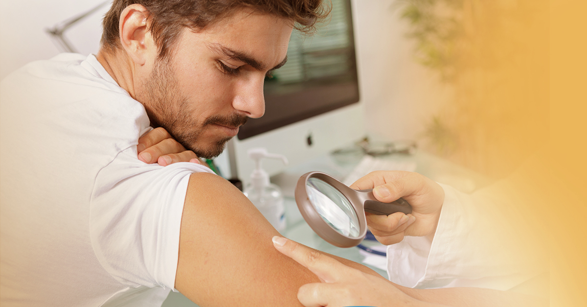 Dezembro Laranja: tudo sobre o câncer de pele melanoma