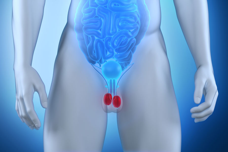 Saiba mais sobre o câncer de testículo